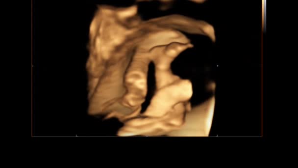 Mozione di ecografia ad ultrasuoni 4D dell'utero materno di un bambino. Concetto di vita, scoperta scientifica — Video Stock