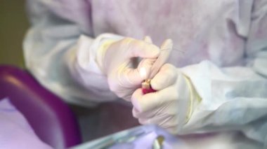 Dentist burning a metallic wire with a lighter