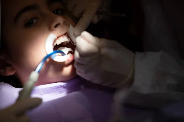 Młoda Dziewczyna Aparacie Otwiera Usta Podczas Badania Zębów Pobliżu Dentysty — Zdjęcie stockowe