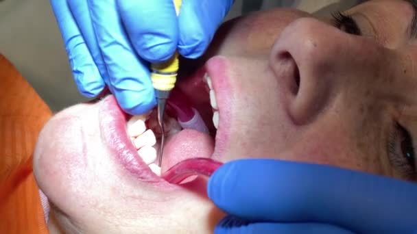 La donna negli anni '50 visita clinica odontoiatrica per il trattamento professionale dei denti. Donna dentista chinarsi paziente. Strumento di supporto medico per la pulizia orale. Cura professionale del mal di denti. Stomatologia. — Video Stock