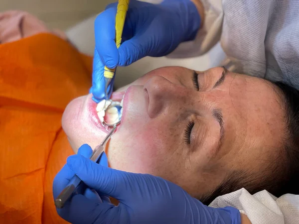 Woman undergoing dental cleaning in the dentist studio.