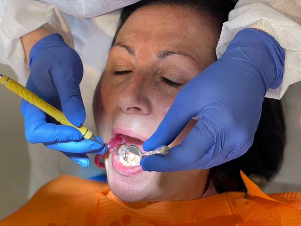Mulher Limpeza Dentária Estúdio Dentista — Fotografia de Stock