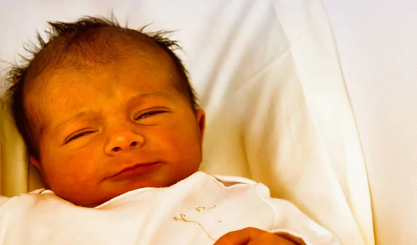 新生儿面部有黄斑的细节 人生的第一天 — 图库照片