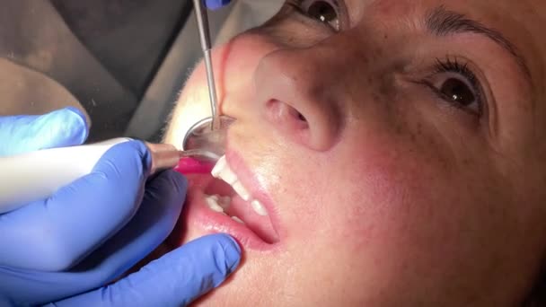 Жінка, яка має стоматологічне лікування в кабінеті стоматолога. Жінка лікується від чищення зубів — стокове відео