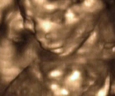 4. Ay Fetüsü 'nün 3D Ultrasonografi Analizi, İtalyan Laboratuvarları