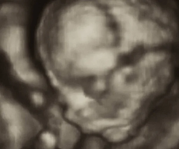 イタリア 4ヶ月の胎児の超音波検査 — ストック写真