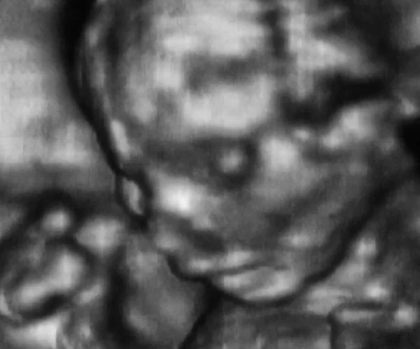 4ヶ月の胎児の3D超音波検査 イタリアの研究所 — ストック写真