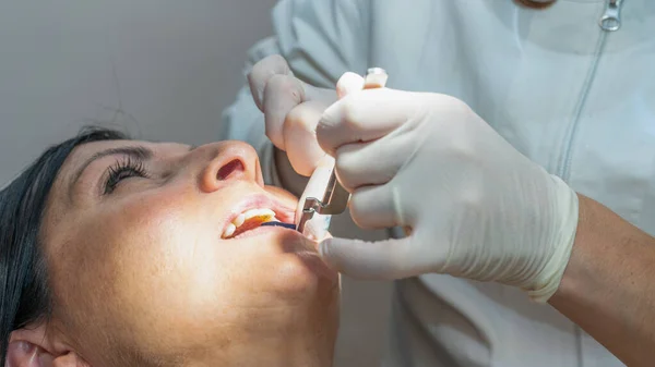 Mulher Década Sorrindo Enquanto Dentista Luvas Látex Branco Verificar Condição — Fotografia de Stock
