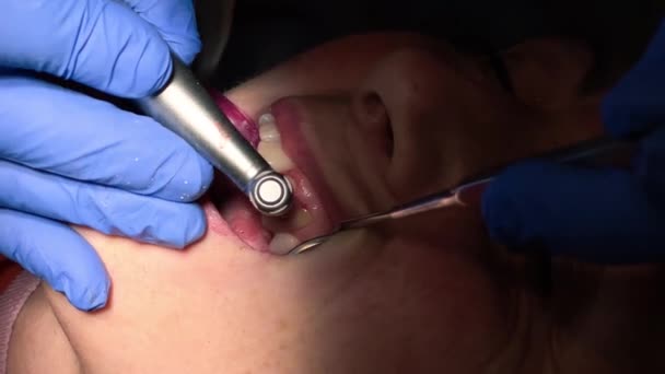 Vrouw met tandheelkundige behandeling bij tandartsen kantoor. Vrouw wordt behandeld voor tanden reinigen — Stockvideo