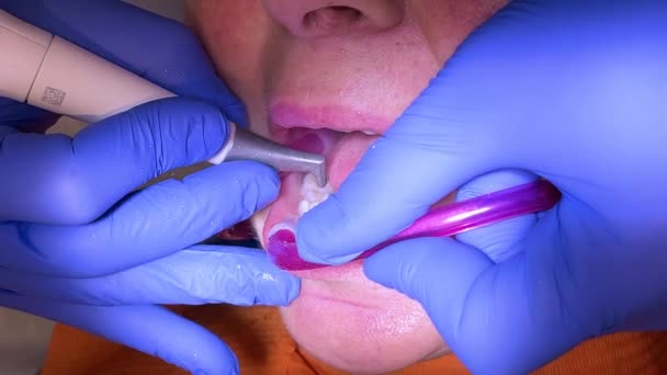 Жінка, яка має стоматологічне лікування в кабінеті стоматолога. Жінка лікується від чищення зубів — стокове відео