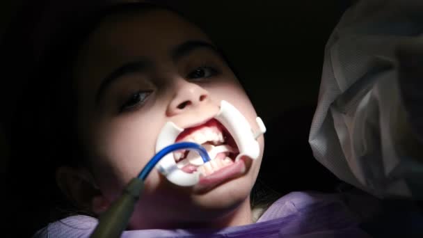 Стоматолог наносить брекети на зуби молодій дівчині в студії — стокове відео