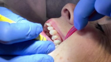 Kadın dişçi muayenehanesinde diş tedavisi görüyor. Kadın diş temizliği için tedavi görüyor.
