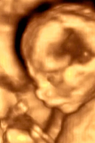 Ultrasonografie Analyse Van Een Maand Fetus Italië — Stockfoto