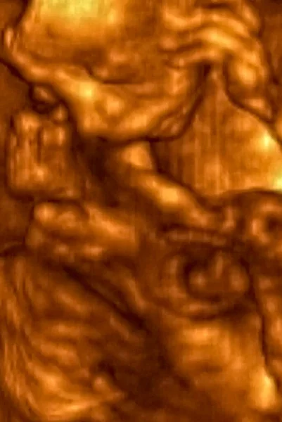 Ultrasonography Analysis 4Th Month Fetus Italian Laboratories — Stock Photo, Image