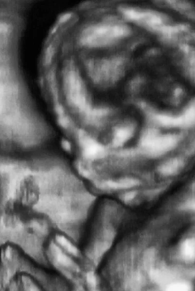 Ultrasonography Analysis 4Th Month Fetus Italian Laboratories — Stock Photo, Image