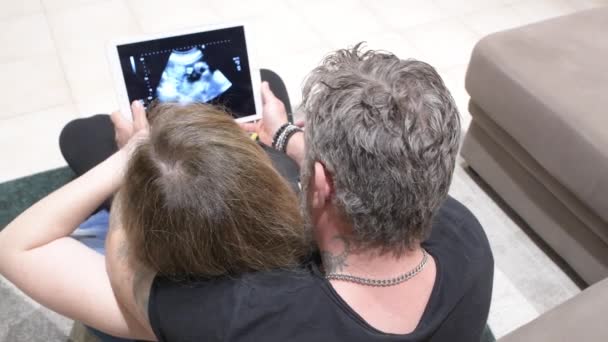 Ecografía ecográfica del feto del cuarto mes vista por los futuros padres en la tableta — Vídeo de stock