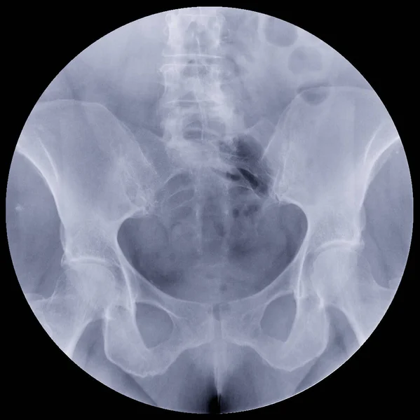 大腸がんを診断するための大腸または結腸の解剖学的構造を示す大腸X線画像または大腸X線図 — ストック写真