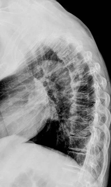 Radiografía Columna Vertebral Humana Resultado Del Examen Médico —  Fotos de Stock