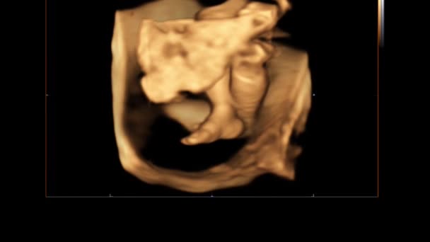 Mozione di ecografia ad ultrasuoni 4D dell'utero materno di un bambino. Concetto di vita, scoperta scientifica — Video Stock