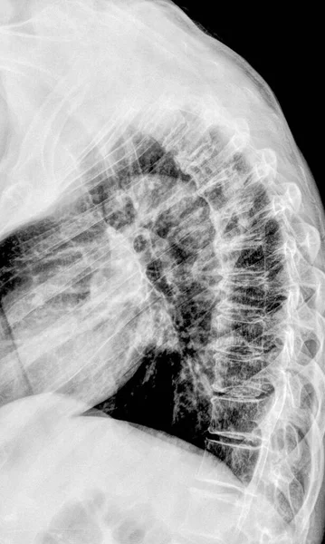 Radiographie Colonne Vertébrale Humaine Résultats Examen Médical — Photo