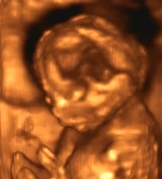 Ultrasonografie analyse van een 4de maand foetus — Stockfoto