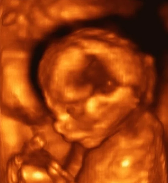 Ultrasonografie analyse van een 4de maand foetus — Stockfoto