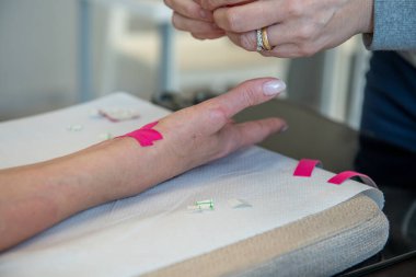 Fizyoterapist, genç bir kadının bileğine ağrı kesici bant yapıştırıyor..