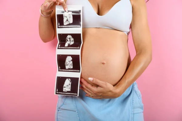 Gravid mamma visar ett ultraljud av sin son — Stockfoto