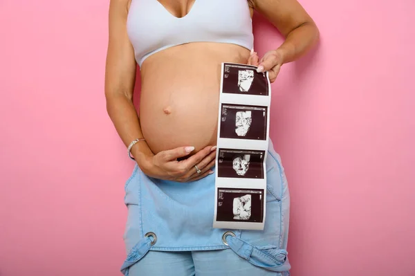 Mãe grávida mostra um ultra-som de seu filho — Fotografia de Stock