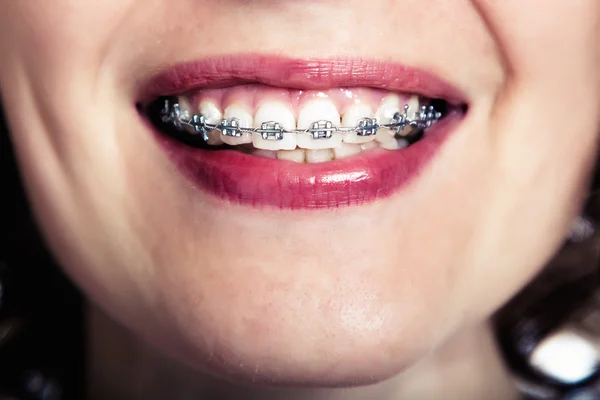 Menina sorridente bonita. — Fotografia de Stock