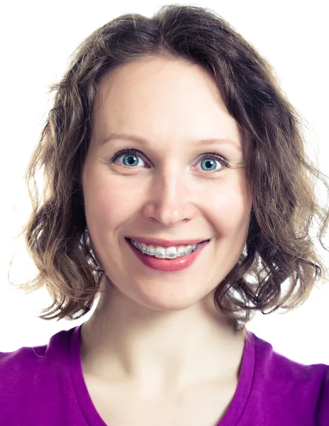 Beautiful smiling girl wearing braces. — Stock Photo, Image