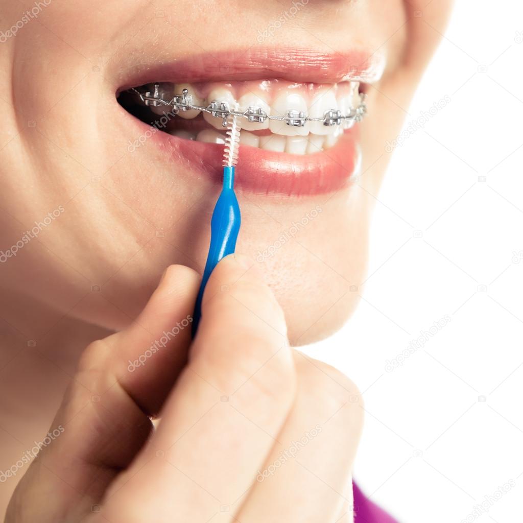 Beautiful smiling girl with retainer for teeth.