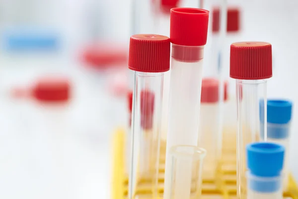 Test tubes in the laboratory — Stock Photo, Image