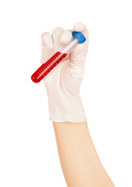 Beyaz bir arka plan üzerinde test tüpü içinde kan tutan el