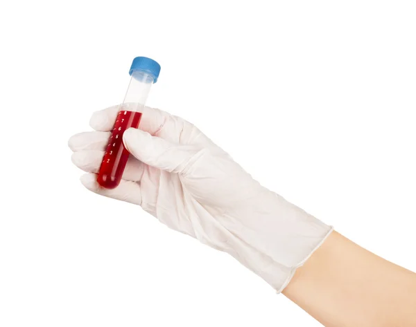 회색 배경에 테스트 튜브에 혈액을 들고 손 — 스톡 사진