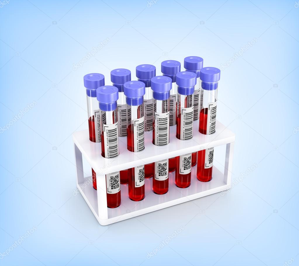 Medical test tubes with blood in a holder on a blue background Stock