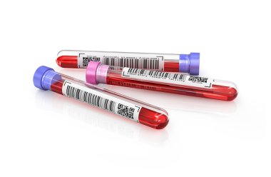 tıbbi test tüpleri