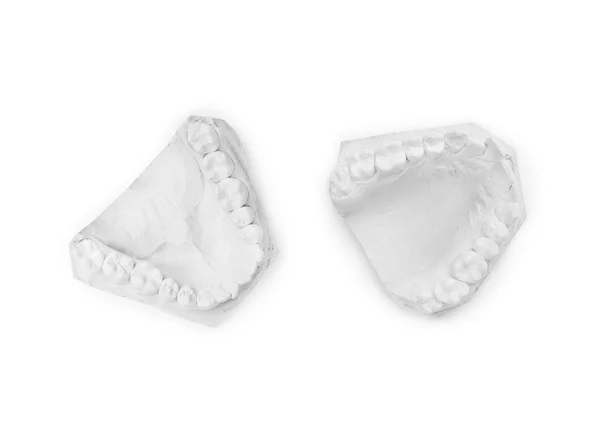 Гипсовая модель челюсти человека на белом фоне — стоковое фото