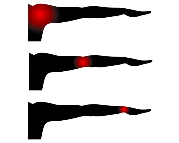 有痛点的人类手臂 — 图库矢量图片