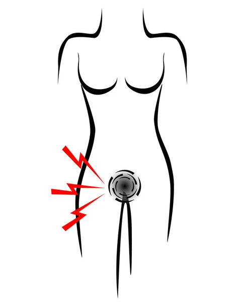 Стилизованное Женское Тело Болевым Мочевым Пузырем — стоковый вектор