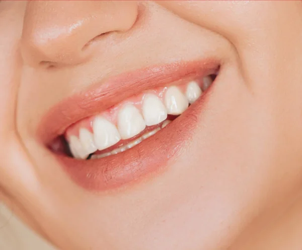 Closeup Smile White Teeth Healthy Female Teeth Toothy Smile — Stock Photo, Image