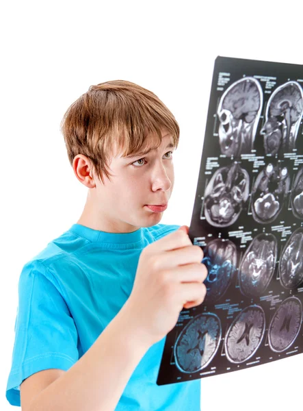 Trieste jongen met tomografie — Stockfoto