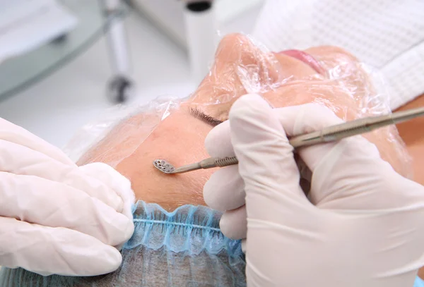 Limpeza profissional de acne em um salão de beleza . — Fotografia de Stock