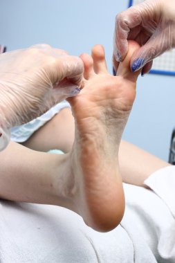 peeling ayak pedikür prosedürü