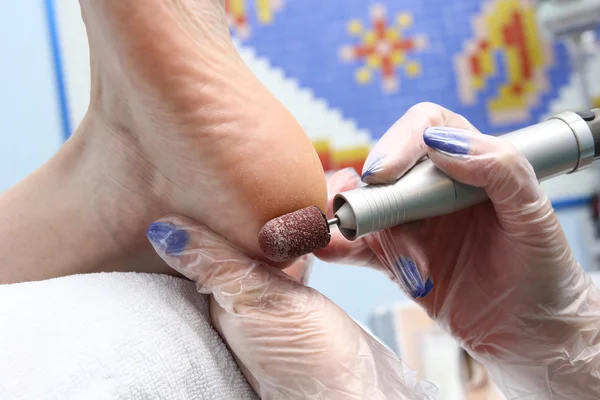 Peeling feet pedicure procedure — Stock Photo, Image