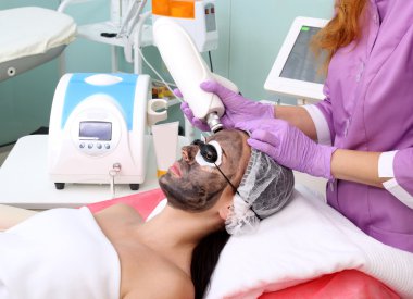 Yordam karbon peeling.