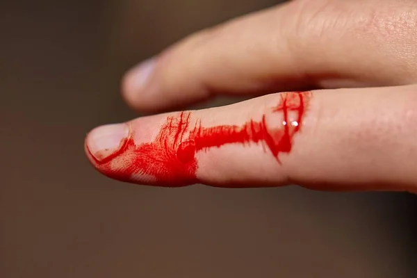 Cut finger bleeding — Stock Photo, Image