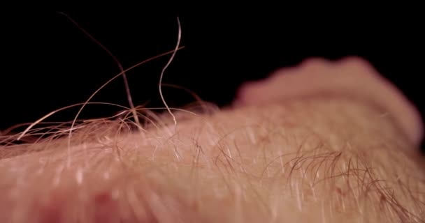 Шкіра руки і волохата макрозондова лінза — стокове відео