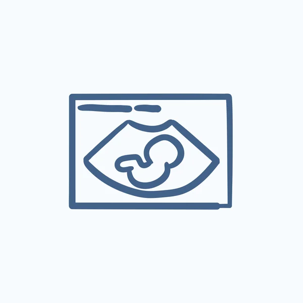 Fetal ultrasound sketch icon. — Stock Vector