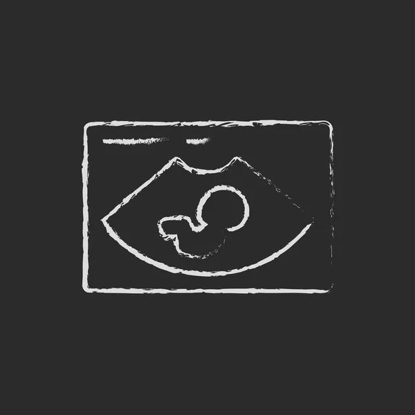 Foetale echografie pictogram opgesteld in krijt. — Stockvector